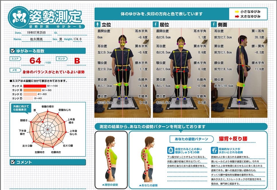 姿勢分析ゆがみーるの見本画像
