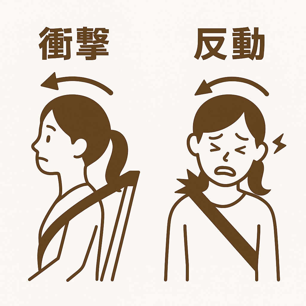 むち打ち、むちうち、ムチウチ症状にどうしてなるか説明画像。 