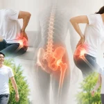 腰や股関節の痛みに悩む男女と、痛みの改善後に歩く様子を示したイメージ